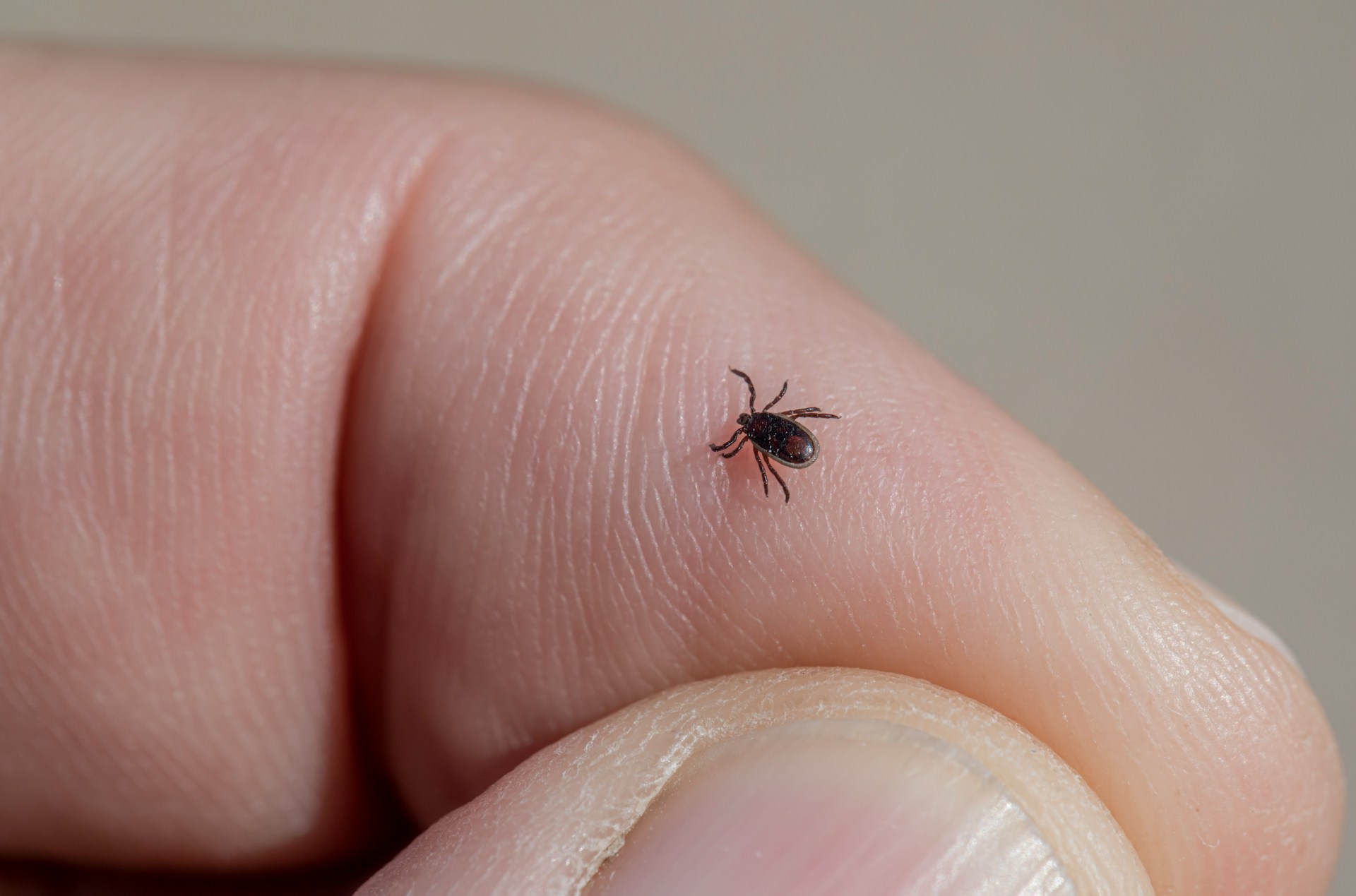 tick prevention